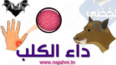 بحث-حول-داء-الكلب