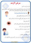 بحث حول مرض الرمد